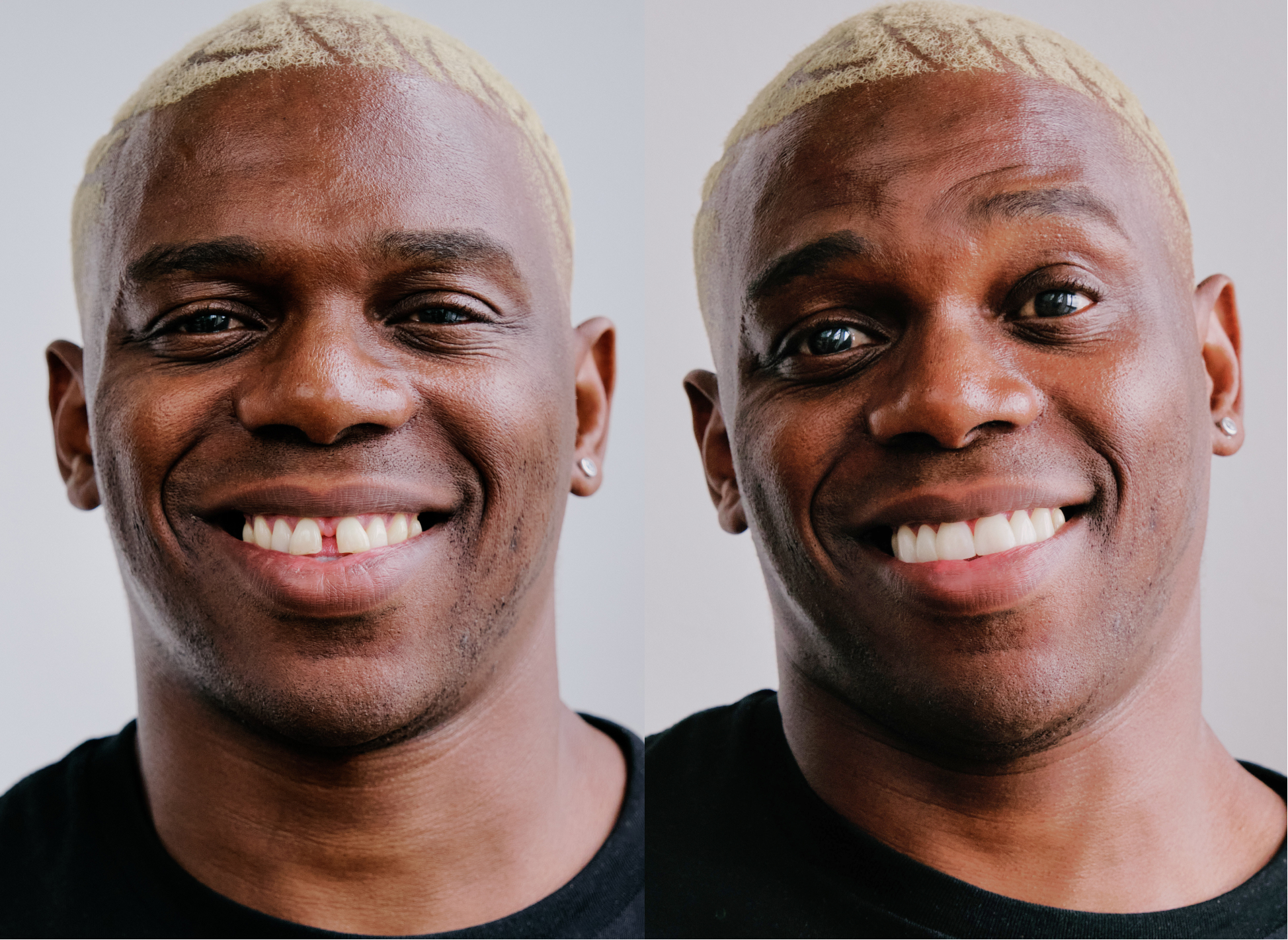 Before And After Person